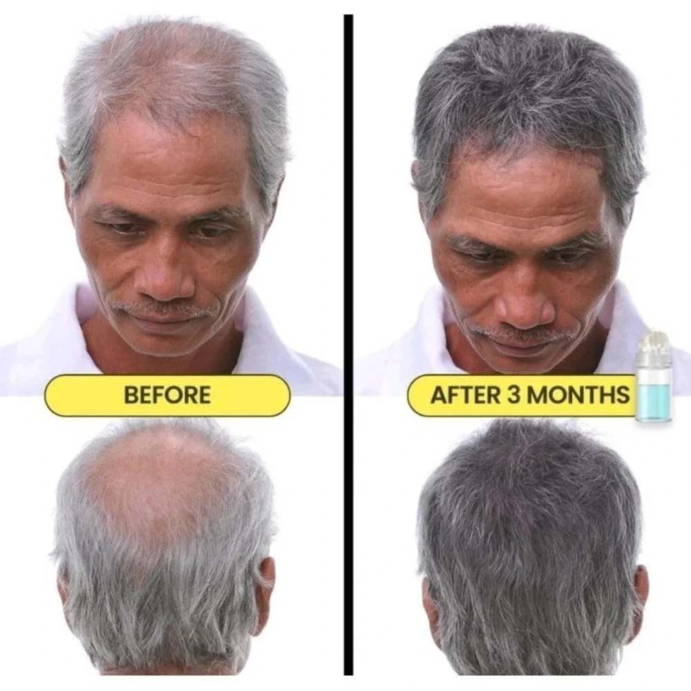 Mikro Re:Grow Your Own Hair Thicker Fuller  1 Month Supply